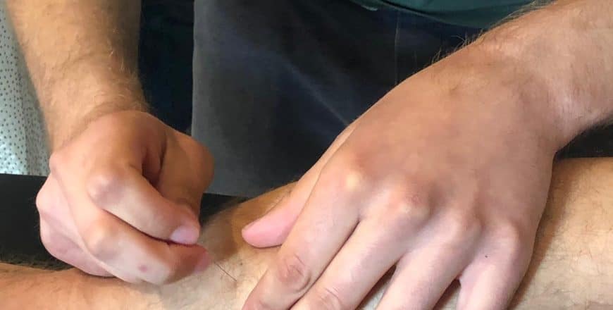 Een man die dry needling uitvoert op het been van een man. AQUS Learning
