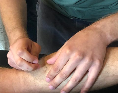 Een man die dry needling uitvoert op het been van een man. AQUS Learning